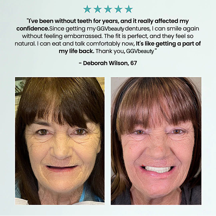 🦷  Fit Full Functional Dentures Make you more confident