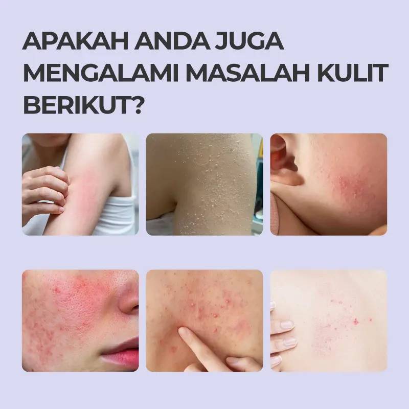 Singello® Skin-Soothing Gel, Skin-Conditioning Gel – Care for Your Skin