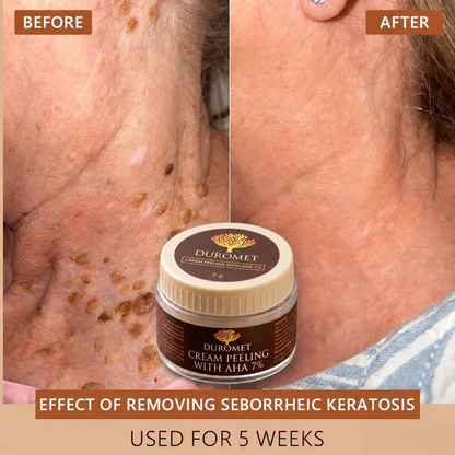 DUROMET™ Cream Peeling With AHA 7% – Exfoliate, Smooth & Reveal Brighter-Looking Skin
