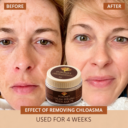 DUROMET™ Cream Peeling With AHA 7% – Exfoliate, Smooth & Reveal Brighter-Looking Skin