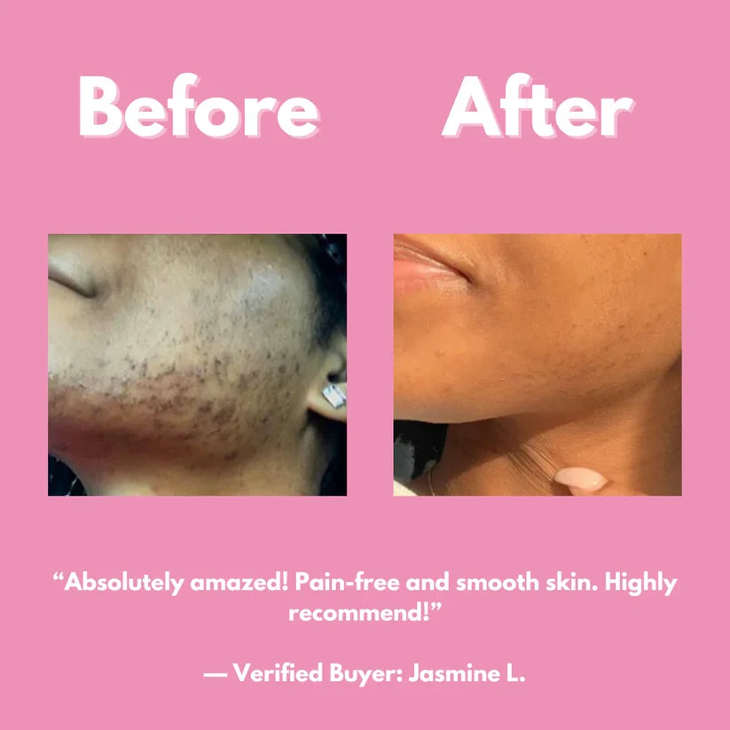 Smooth & Shine Hair Removal Kit