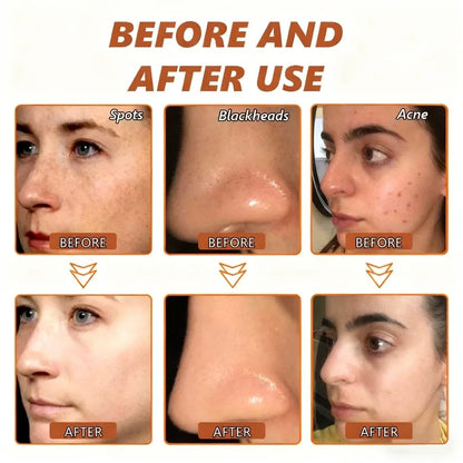 DUROMET™ Cream Peeling With AHA 7% – Exfoliate, Smooth & Reveal Brighter-Looking Skin