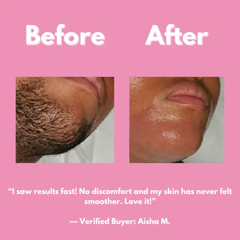 Smooth & Shine Hair Removal Kit