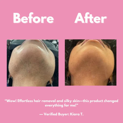 Smooth & Shine Hair Removal Kit