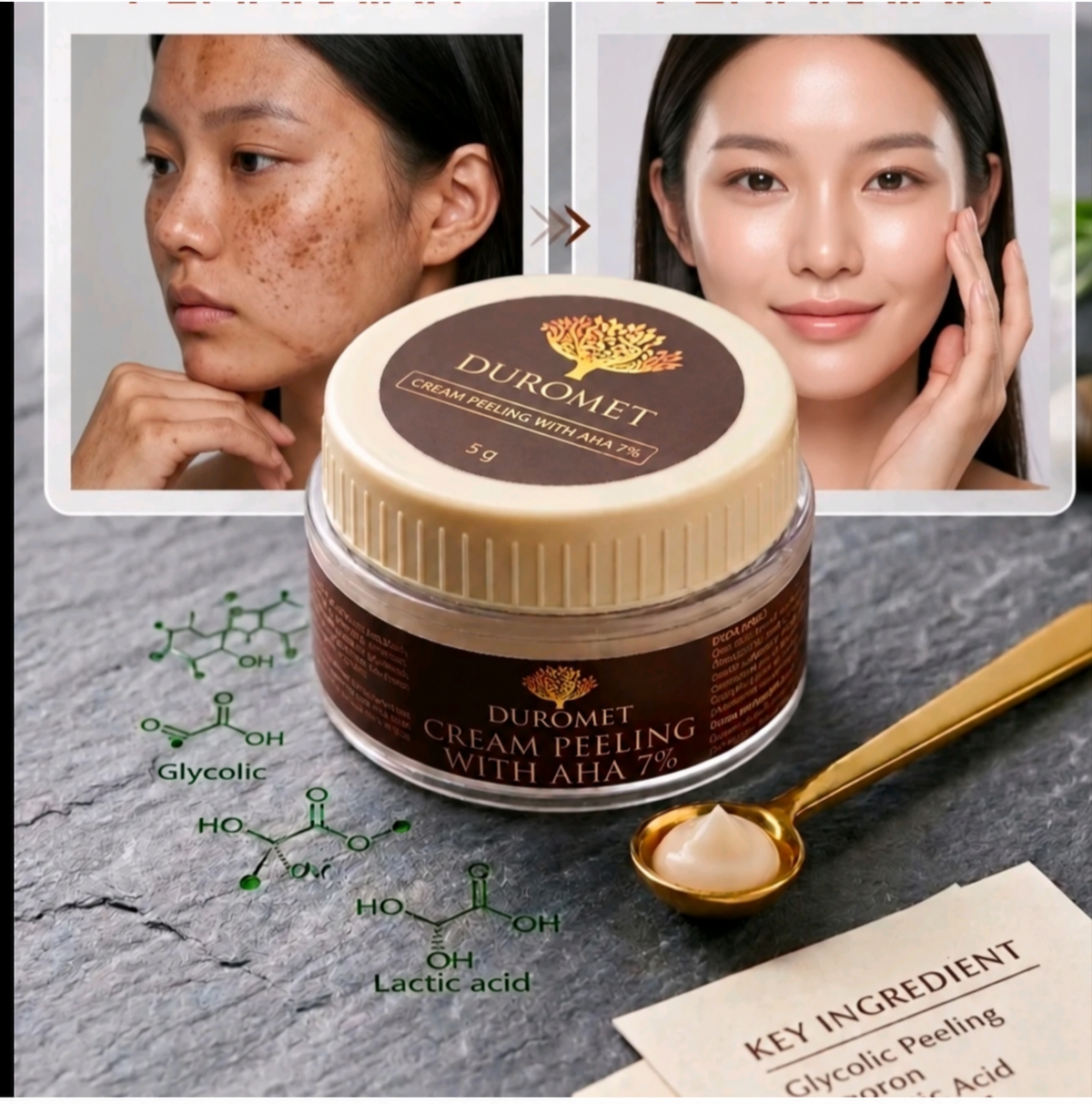 DUROMET™ Cream Peeling With AHA 7% – Exfoliate, Smooth & Reveal Brighter-Looking Skin