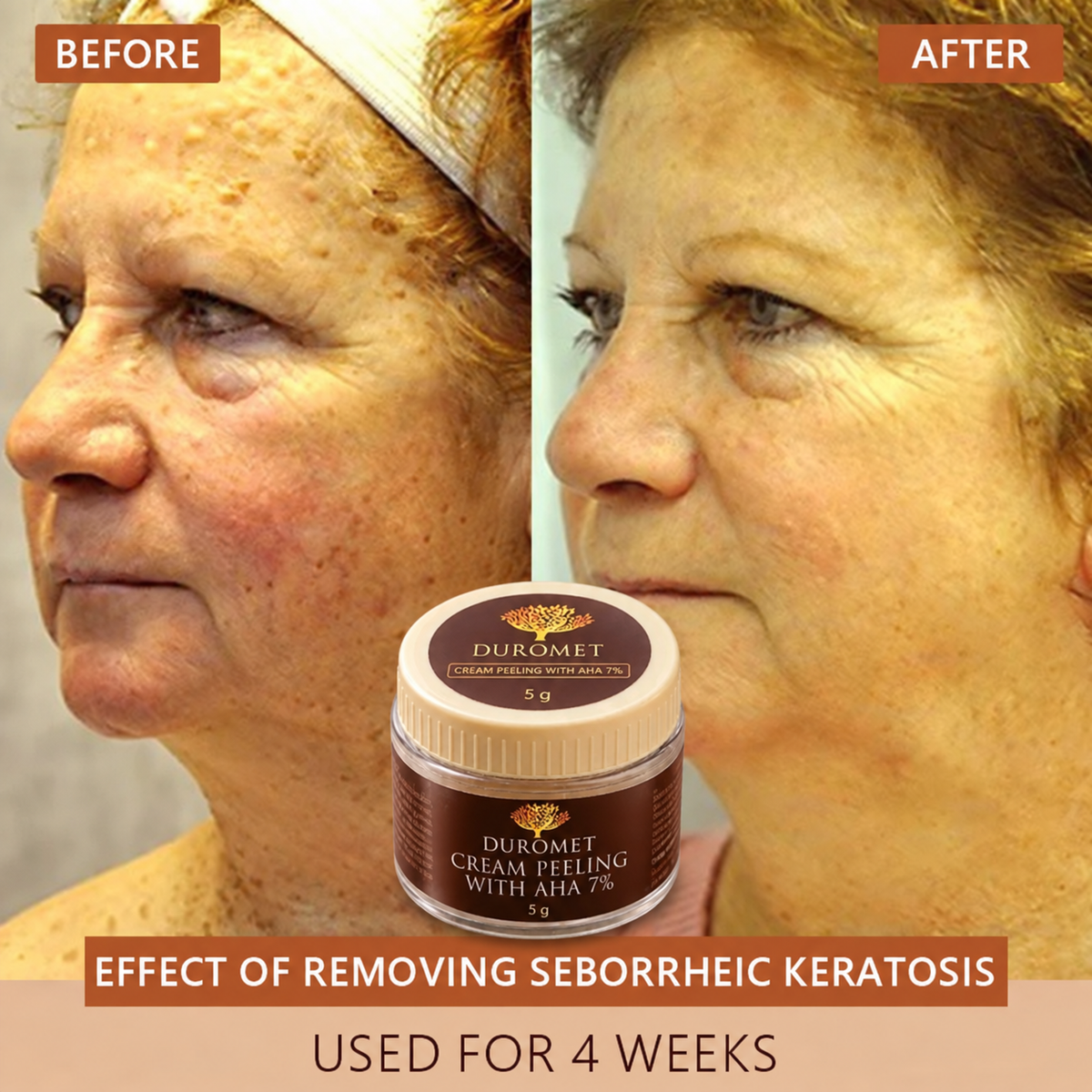 DUROMET™ Cream Peeling With AHA 7% – Exfoliate, Smooth & Reveal Brighter-Looking Skin