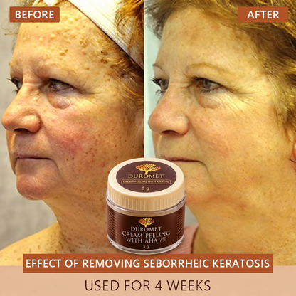 DUROMET™ Cream Peeling With AHA 7% – Exfoliate, Smooth & Reveal Brighter-Looking Skin