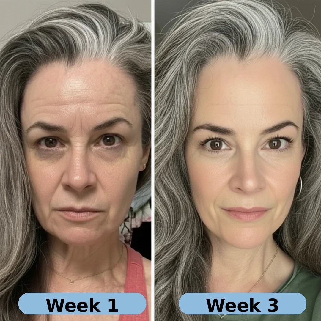 🔥LAST DAY Buy 1 Get 1 Free🔥| Korean Collagen Serum for Mature Skin