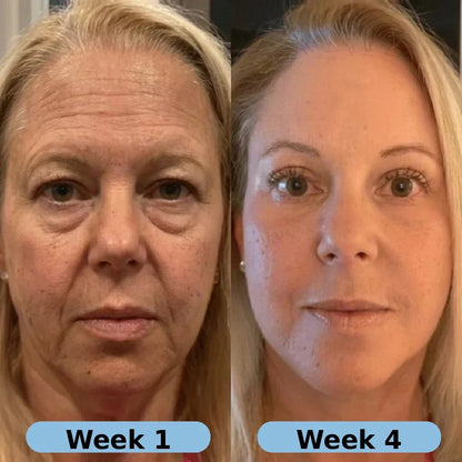 🔥LAST DAY Buy 1 Get 1 Free🔥| Korean Collagen Serum for Mature Skin