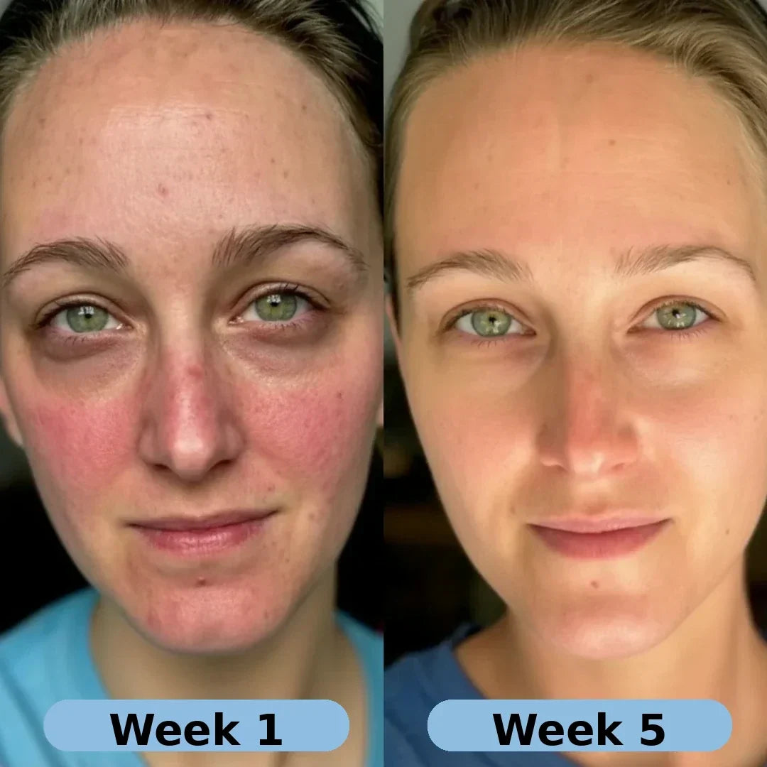 🔥LAST DAY Buy 1 Get 1 Free🔥| Korean Collagen Serum for Mature Skin