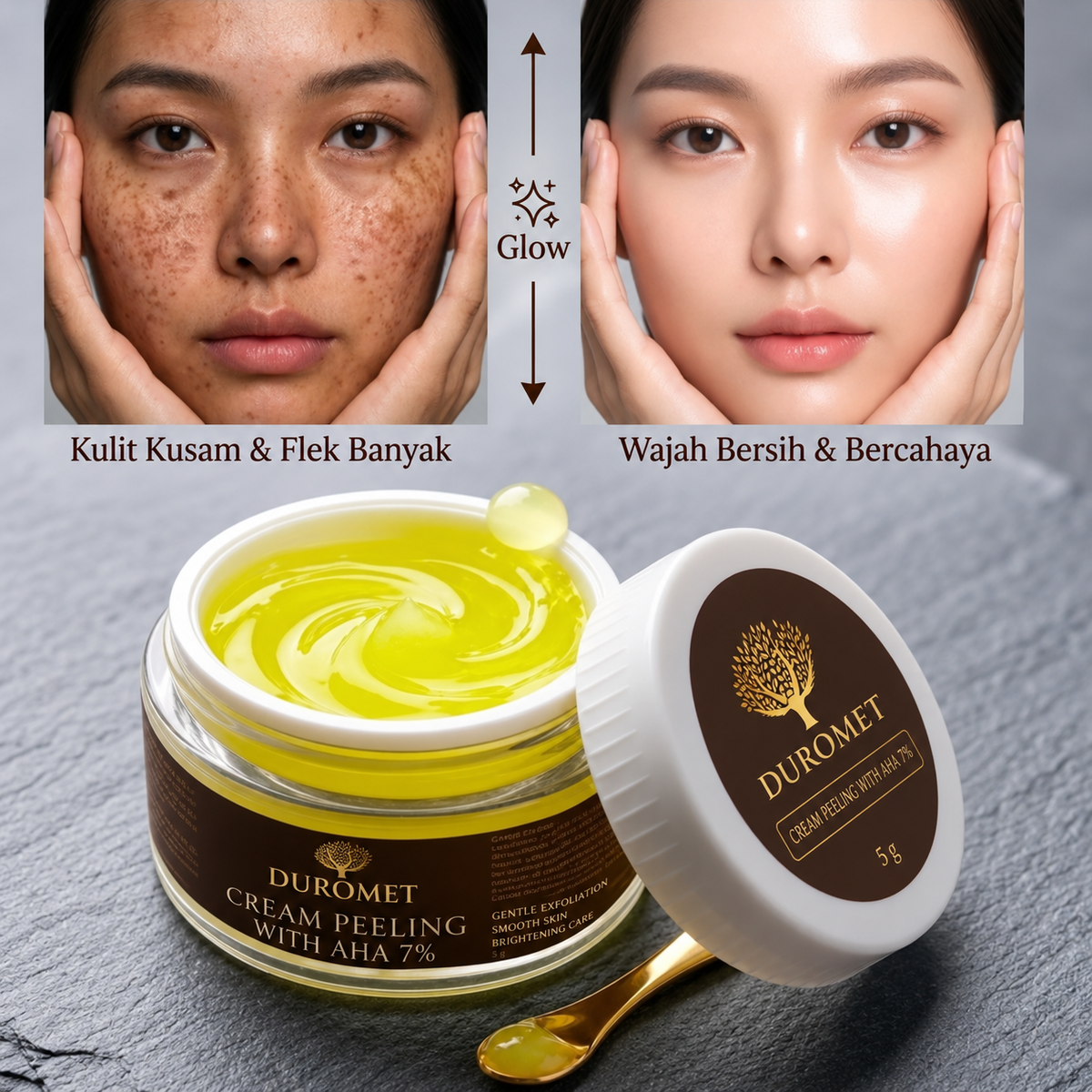 DUROMET™ Cream Peeling With AHA 7% – Exfoliate, Smooth & Reveal Brighter-Looking Skin