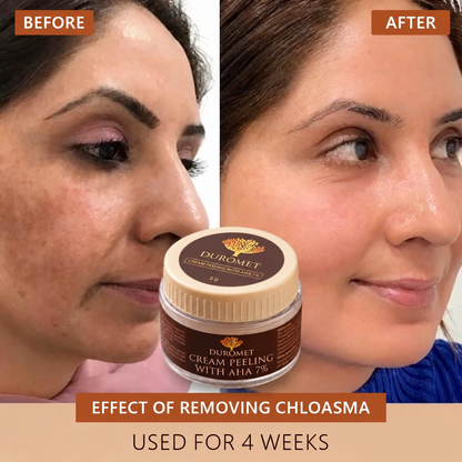 DUROMET™ Cream Peeling With AHA 7% – Exfoliate, Smooth & Reveal Brighter-Looking Skin
