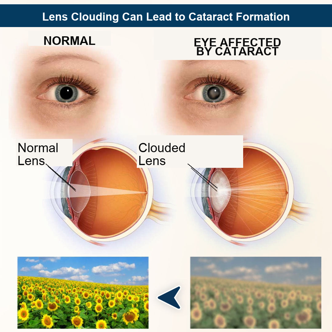 Duromet® OptiFusion Vision Support – Eye care patch for vision support